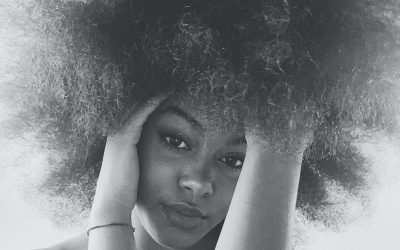What Is Hairline Acne And What To Do About It